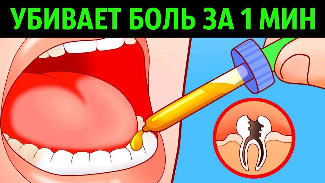 10 Способов Убить Зубную Боль за Минуту