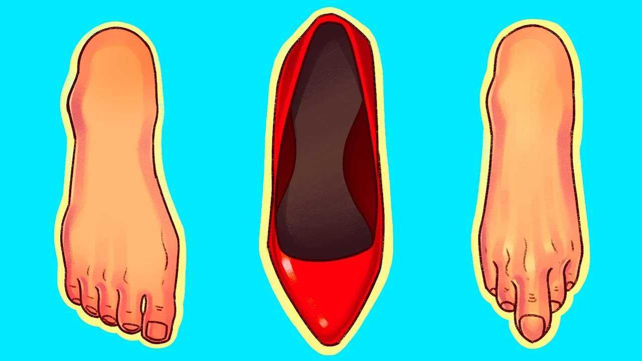 6 типов обуви, которые наносят необратимый ущерб вашим стопам