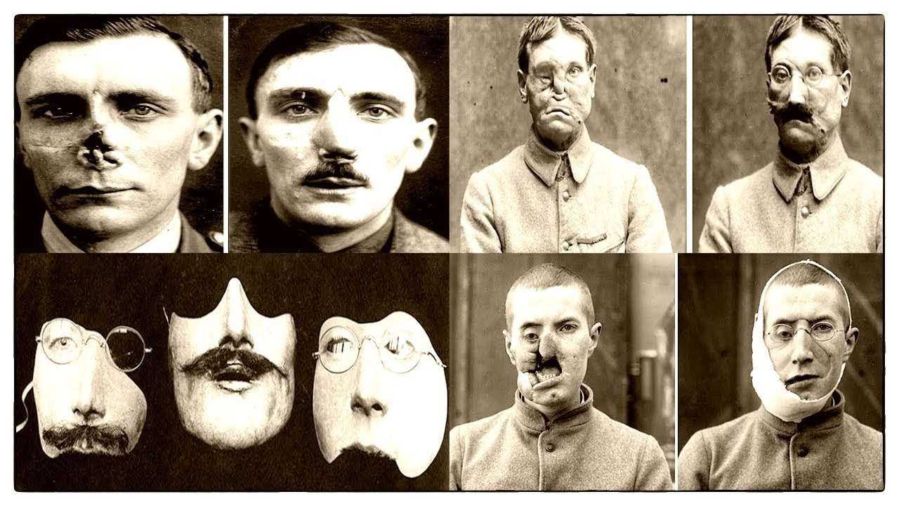 Новые лица солдат после 1 мировой войны